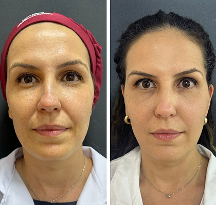 6fdfa136-91d4-464b-b988-03e766549c07 1